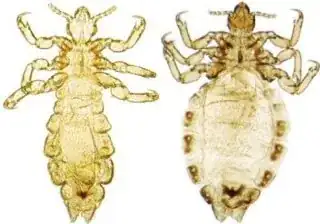 Image — Head louse on the left, clothing louse on the right