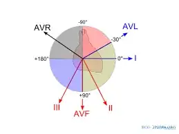 Electical axis of ECG leads