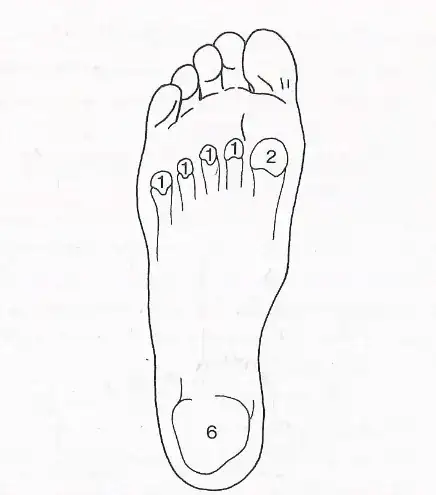 Image of load points of the foot.