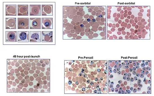 Blood stages of P.falciparum