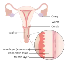 Diagram of the female reproductive anatomy with layers of the vaginal wall enhanced and labeled