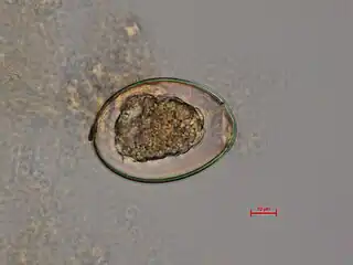 Diphyllobothrium latum - fertilized egg