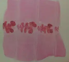 Diphyllobothrium latum proglottid