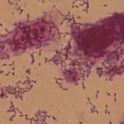 Aggregative adherence pattern of EAEC