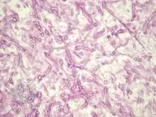 Non-septate hyphae. Hyphae are broad and ribbon-like.