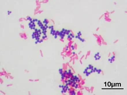 Violet-stained gram-positive cocci and pink-stained gram-negative bacilli
