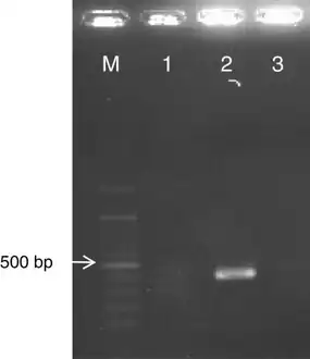 RT-PCR product (443bp) of human corona virus HKU1–specific primers, lane M, size marker (100bp); lane 1 Negative control RT-PCR mix; lane 2 HKU1
