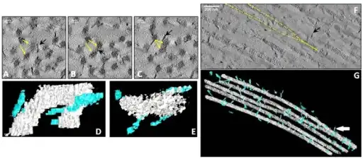 a-g)3-D reconstruction showing collagen fusing in areas of abnormal lamellae in CSCD.