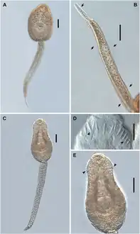 Cercariae of Echinostoma revolutum from snails