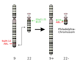 T(9,22) translocation