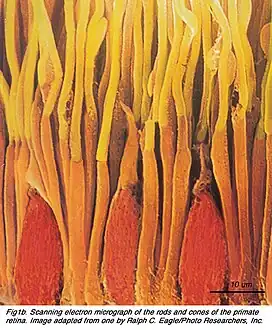 Scanning electron micrograph depicting the retinal rod and cone photoreceptors. The elongated rods are colored yellow and orange, while the shorter cones are colored red.