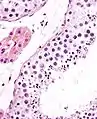 Seminiferous tubule (right) with sperm (black, tiny, ovoid). H&E stain.