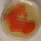 Serratia marcescens: red pigmentation: although considered characteristic of the species, only about 10% of specimens produce this pigment: 236 