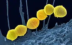 Scanning electron micrograph of Group A Streptococcus (Streptococcus pyogenes) bacteria yellow and a human neutrophil blue’’