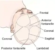 The Coronal suture