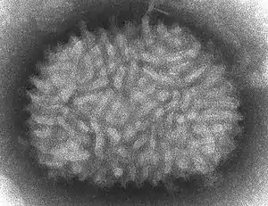 A TEM micrograp of "Vaccinia virus" virions