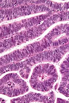 Very high magnification