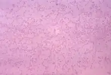 Gram-stained photomicrograph depicting numerous "Pasteurella multocida" bacteria