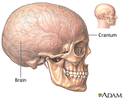 Craniotomy - series Craniotomy - series