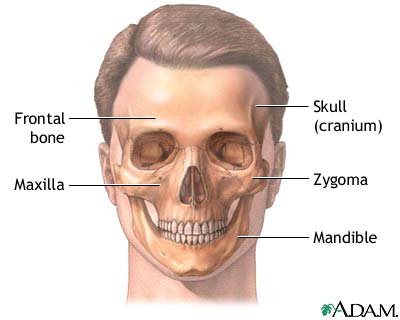 Craniofacial reconstruction - series Craniofacial reconstruction - series