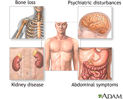 Indications Indications