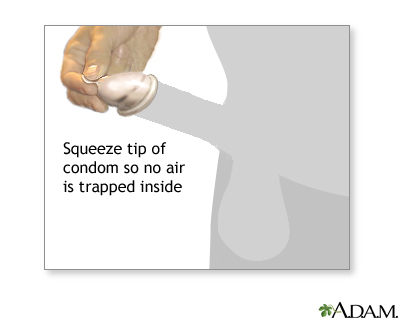 Procedure, part 2 Procedure, part 2