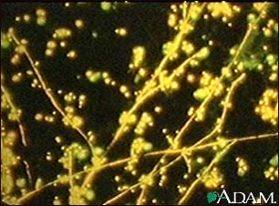 Candida - fluorescent stain