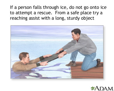 Drowning rescue on ice, board assist Drowning rescue on ice, board assist