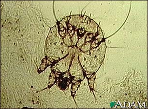 Scabies mite - photomicrograph