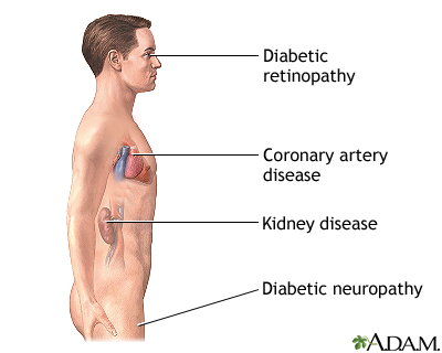 Indications Indications