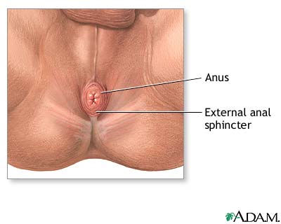 Anal fissure - series Anal fissure - series