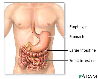 Inflammatory bowel disease - series Inflammatory bowel disease - series