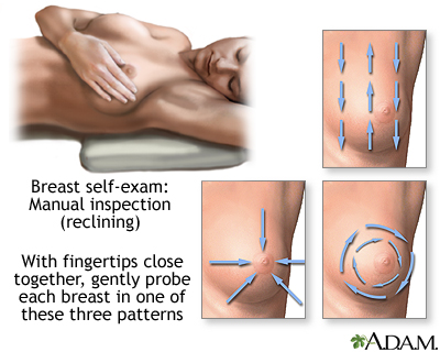 Breast self-exam Breast self-exam