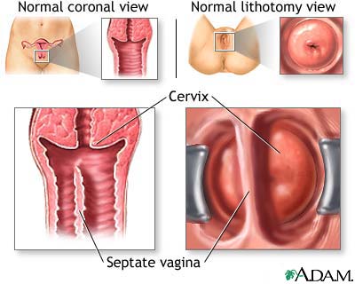 Developmental disorders of the vagina and vulva Developmental disorders of the vagina and vulva