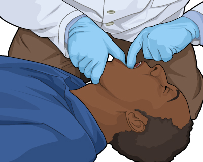 First Aid for Choking - unconscious adult or child over 1 year