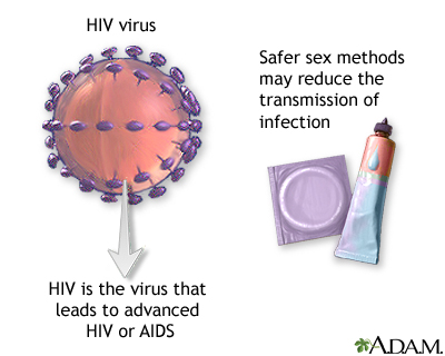 HIV HIV