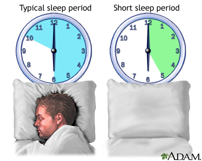 Natural short sleeper Natural short sleeper