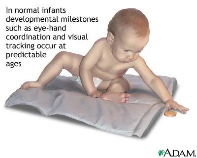 Motormental disability