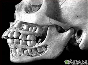 Teeth, adult - in the skull Teeth, adult - in the skull