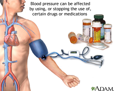Drug induced hypertension Drug induced hypertension