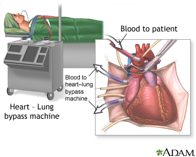 Procedure, part 1 Procedure, part 1