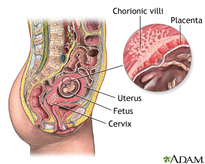 Chorionic villus sampling - normal anatomy