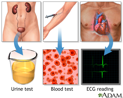 High blood pressure tests High blood pressure tests