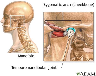 Causes of secondary headache Causes of secondary headache