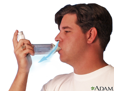 Spacer Use - Part Five