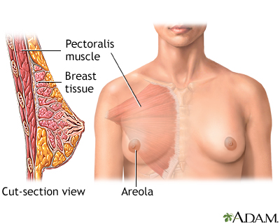 Breast augmentation - series - Normal anatomy
