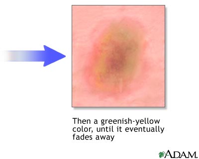 Healing, part 2 Healing, part 2