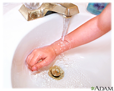 Minor cut - first aid Minor cut - first aid