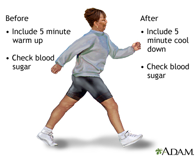 Diabetes and exercise Diabetes and exercise