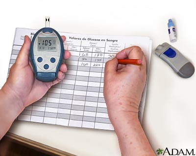 Monitoring blood glucose - Record your reading Monitoring blood glucose - Record your reading